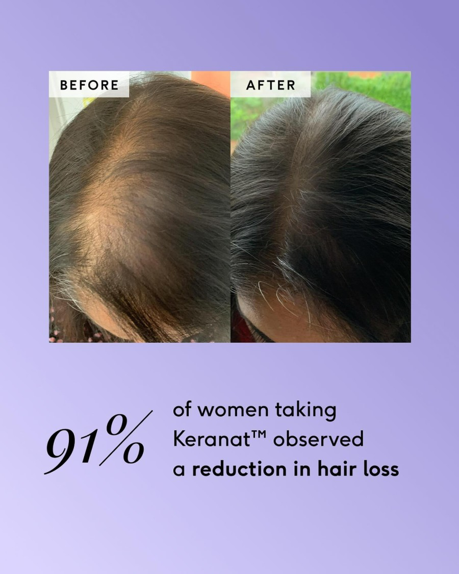 Feel hair support